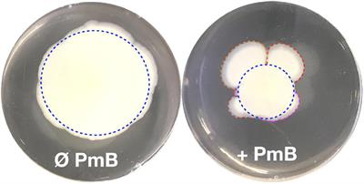 Experimental evolution of Vibrio cholerae identifies hypervesiculation as a way to increase motility in the presence of polymyxin B